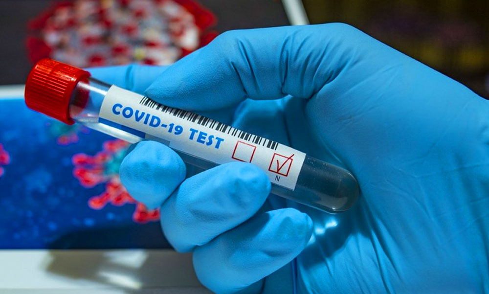 Újabb 43 halálos áldozatot követelt itthon a koronavírus – A volt tiszti főorvos szerint beláthatatlan katasztrófa várható