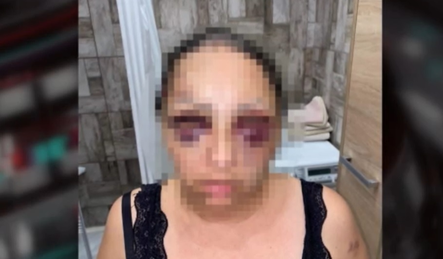 Brutálisan bántalmazta élettársát egy férfi Pest megyében: ököllel ütötte és fogva is tartotta a nőt – videó