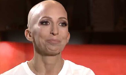 Rubint Réka döbbenetes vallomása: évek óta daganatos betegséggel küzd, a kezelések miatt a haját is elveszítette