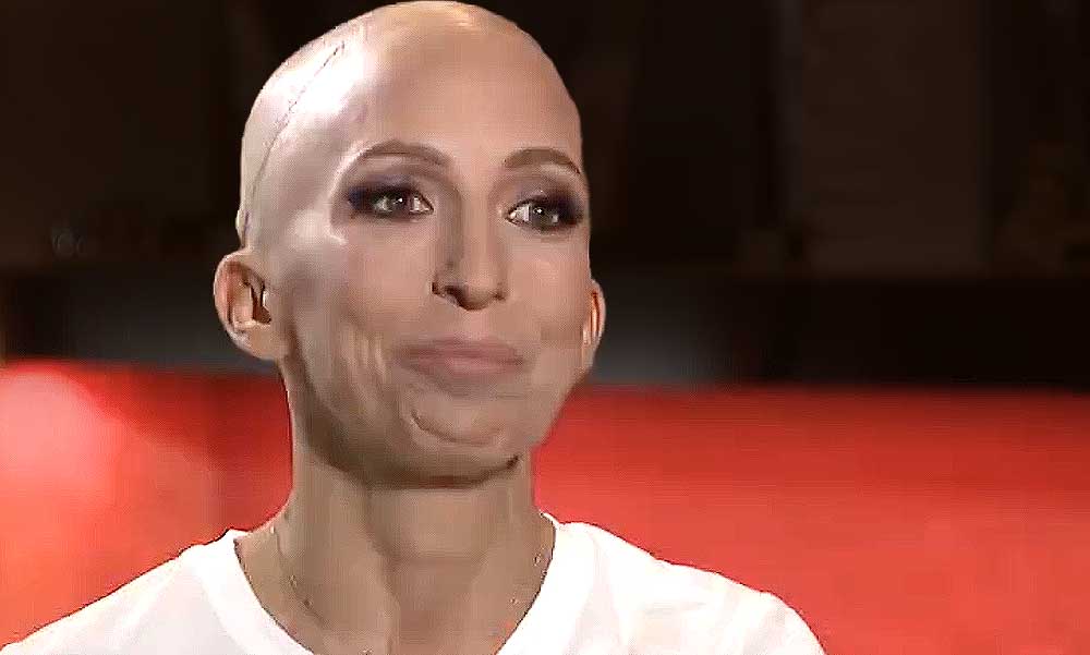 Rubint Réka döbbenetes vallomása: évek óta daganatos betegséggel küzd, a kezelések miatt a haját is elveszítette