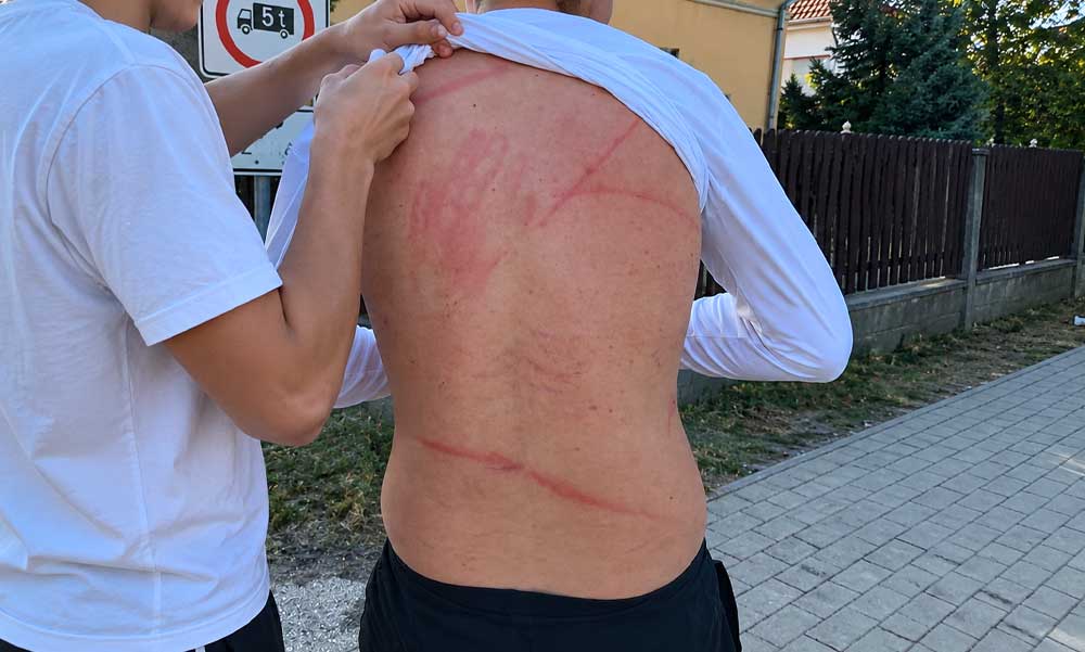 Brutális támadás Pilisen: Botokkal és faágakkal vertek véresre egy 15 éves fiút, a polgármester rendőrségi fellépést követel